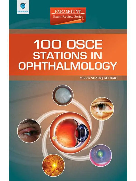 100 OSCE STATIONS IN OPHTHALMOLOGY