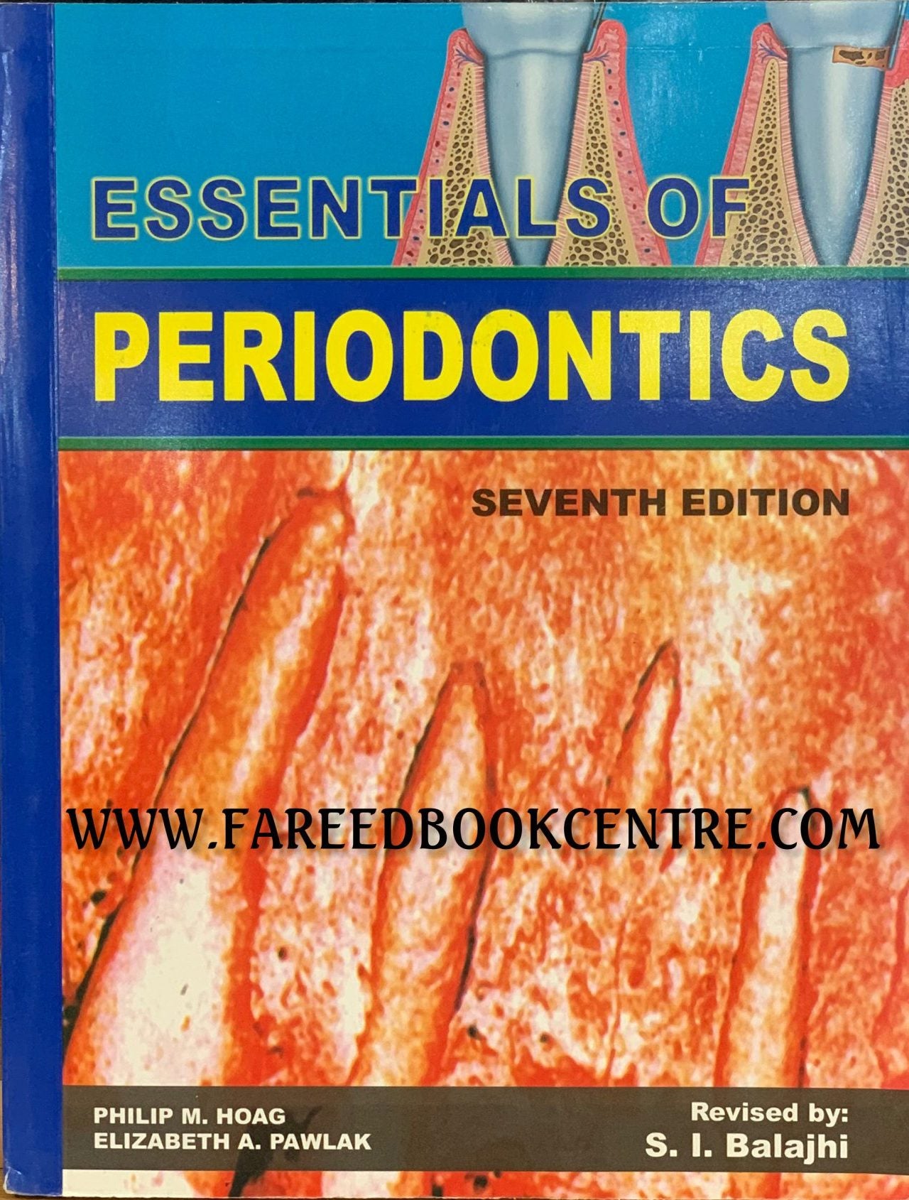 periodontics-vincentia-dental-care-vincentia-nsw