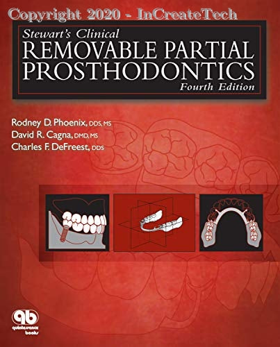 Stewart Clinical Removeable Partial Prosthodontics 4th edition Colour Matt Print