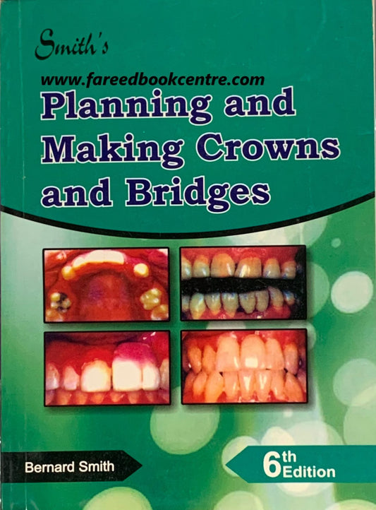 Smiths Planning and Making Crowns and Bridges 6th Edition